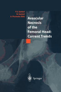Avascular Necrosis of the Femoral Head: Current Trends: Current Trends cover