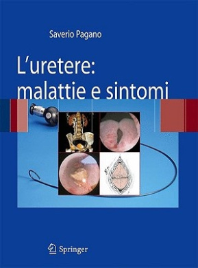 L'uretere: malattie e sintomi cover
